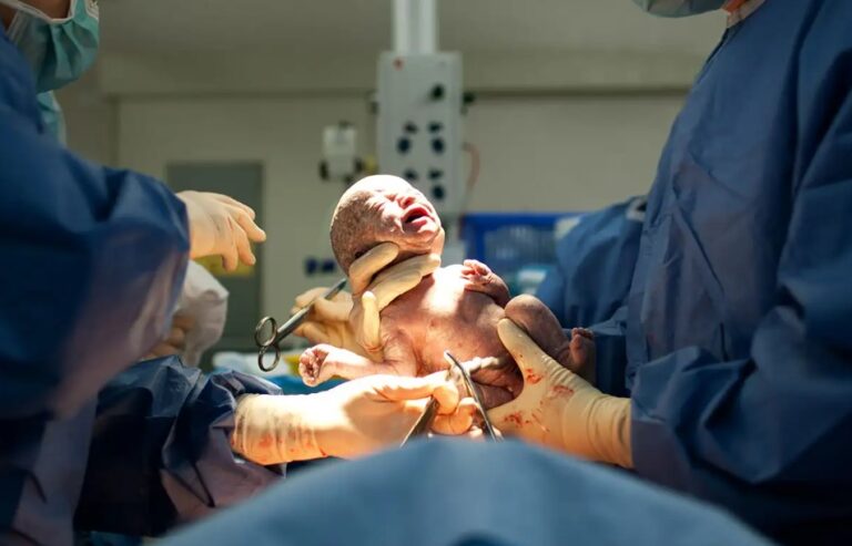Risks of Cesarean Section in a Child During the First Year of Life